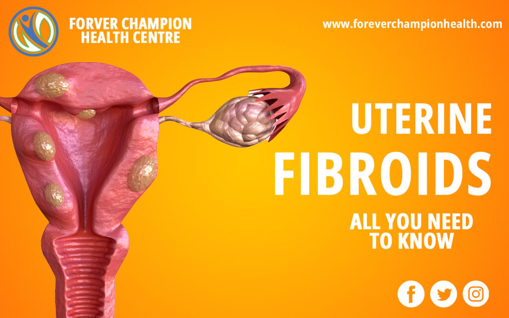 Fibroid